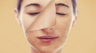 Những loại thực phẩm khiến cơ thể lão hoá từng ngày, 'ăn mòn' sức khoẻ mà nhiều người vẫn ăn
