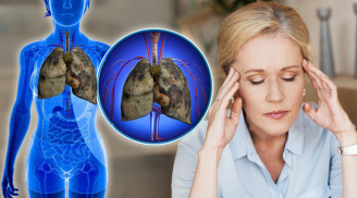 Tín hiệu cảnh báo ung thư phổi đang tấn công cơ thể, chớ dại mà coi thường