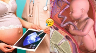 Dấu hiệu báo động bà bầu thiếu hụt canxi trầm trọng, cần bổ sung ngay kẻo con sinh ra 'lùn tịt'