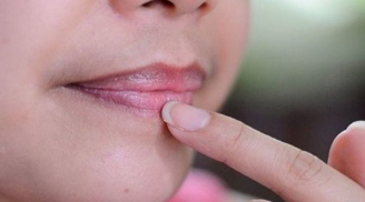 Thấy có 4 dấu hiệu nhỏ này trên môi, mặt, tay, hãy đến gặp bác sĩ ngay lập tức