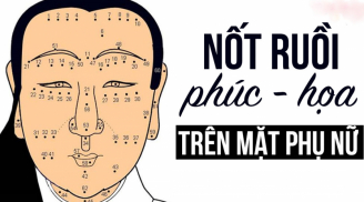Nốt ruồi 'phá tài cản lộc' trên cơ thể khiến thần Tài 'chán ngán', cần xóa đi