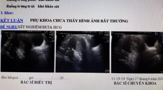 Khệ nệ mang bụng bầu đi đẻ, đến bệnh viện vợ chồng 'sốc' khi bác sĩ thông báo... không có thai
