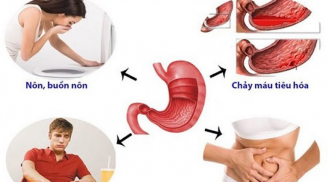 Những dấu hiệu cảnh báo đau dạ dày, rất nhiều người mắc bệnh mà không biết