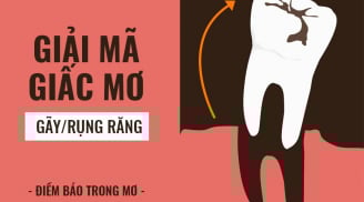 Ngủ mơ bị gãy răng, chảy máu có phải là điềm xui?