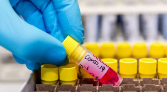 Malaysia phát hiện biến chủng SARS-CoV-2 nguy hiểm hơn 10 lần virus ở Vũ Hán