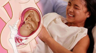 Dấu hiệu bà bầu chuyển dạ sắp sinh chính xác nhất, ai cũng cần biết