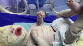 Bé sơ sinh mắc bệnh lạ, toàn thân bao phủ lớp sừng trắng, nứt từng mảng