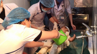 Cháu bé 2 tuổi bị nhiễm trùng nặng vì người nhà chữa bỏng bằng nước mắm và rượu