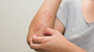 Có 1 trong 6 dấu hiệu này vào buổi tối thì 100% gan của bạn đang gặp nguy, đi khám ngay còn kịp