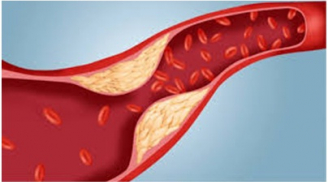 Việt Nam: Phát hiện cây thuốc quý mọc khắp nơi trị rối loạn lipid máu