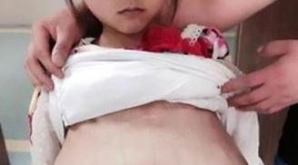 Sốc: bé 12 tuổi được người chồng 40 tuổi đưa đi khám thai