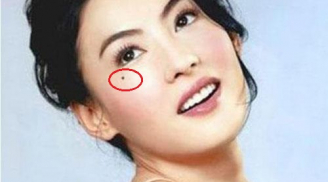 Nốt ruồi “Lệ Đường” ở phụ nữ, may mắn hay đau khổ một đời?