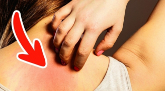 Đây chính là những dấu hiệu ung thư thời kỳ đầu mà hầu hết mọi người thường hay bỏ qua