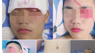Cô vợ tai quái dán băng vệ sinh vào mặt, chụp ảnh chồng không mặc gì... vì tội ham nhậu nhẹt
