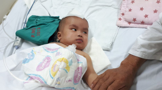 Bé gái 6 tháng tuổi bị chấn thương sọ não nguy kịch do ngã võng