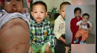 Tan máu bẩm sinh là bệnh gì - vì sao đây được xem là quả bom nguyên tử?