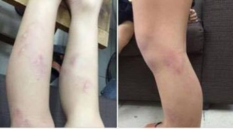 Vụ 11 học sinh lớp 2 bị cô giáo bạo hành: Cháu đã khóc rất nhiều nhưng càng khóc, cô càng quật