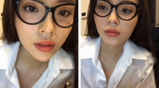 Khuôn mặt biến đổi khác lạ, Kỳ Duyên vẫn tiếp tục bị nghi dao kéo điểm này?