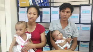 Cuộc sống mới của hai bé gái song sinh dính liền phần dưới: Mẹ vui mừng vì các con đã... có mông