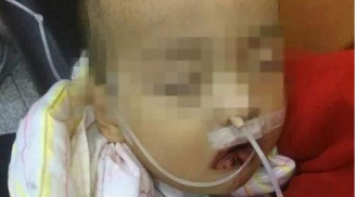 Lầm tưởng chất tẩy là đường trắng, bé trai lấy ăn và nhập viện trong tình trạng nguy kịch