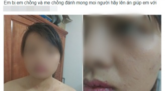 Không chịu nộp toàn bộ thu nhập của gia đình cho mẹ chồng, nàng dâu bị nhà chồng đánh bầm dập