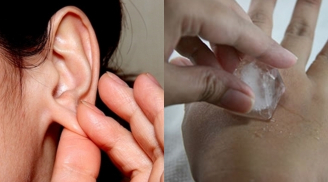 14 mẹo dân gian giúp xua tan các cơn đau nhanh chóng ai cũng cần phải biết