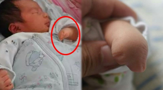 Con sinh ra không có ngón tay, khi nghe bác sĩ tiết lộ nguyên nhân bố mẹ khóc thét không ngờ