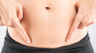 6 bí quyết để mẹ khỏe con ngoan sau sinh mổ