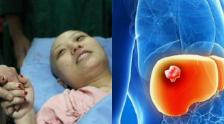 Bị ung thư giai đoạn cuối vì thức khuya - Lời khuyên của bác sĩ
