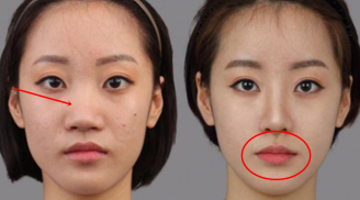 4 bộ phận trên gương mặt nếu phẫu thuật thẩm mỹ thì sẽ phá tướng, thay đổi vận mệnh con người