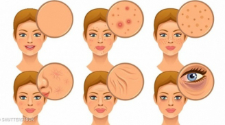 Những thực phẩm yêu thích nhưng chị em càng ăn nhiều da càng xấu