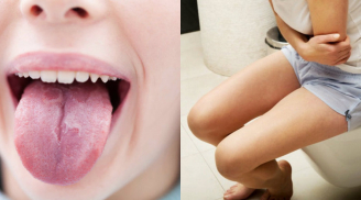 Nếu thấy cơ thể xuất hiện những dấu hiệu này, bạn nên thải độc cơ thể và gặp bác sĩ ngay