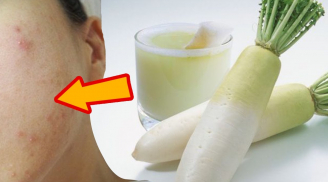 Củ cải không chỉ để nấu các món ngon mà còn có tác dụng chữa bệnh thần kỳ có thể bạn chưa biết