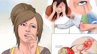 Thấy bạn bè người thân có dấu hiệu này trong lúc ăn cơm hãy đưa họ đi viện gấp coi chừng xuất huyết não
