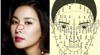 4 nốt ruồi phú quý ''lộc lá'' quanh năm và 3 nốt ruồi tán lộc xui xẻo vạn phần