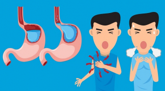 Tuyệt đối đừng coi thường ợ nóng nó có thể là dấu hiệu của nhiều căn bệnh tiềm ẩn