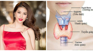 Hoa hậu Phạm Hương âm thầm sang Mỹ để chữa bệnh, căn bệnh cô mắc nguy hiểm thế nào?