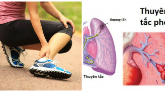 Nữ phóng viên trẻ qua đời sau 12 ngày bị vấp ngã khi chạy bộ và lời cảnh báo căn bệnh rất nguy hiểm