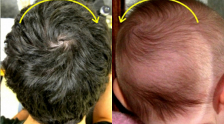 Vạch tóc đếm XOÁY trên đỉnh đầu con TIÊN ĐOÁN vận mệnh cuộc đời một cách chuẩn xác bất ngờ