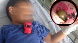 Ve chó làm tổ lúc nhúc trong tai bé trai, mẹ hoảng hồn khi biết nguyên nhân thực sự