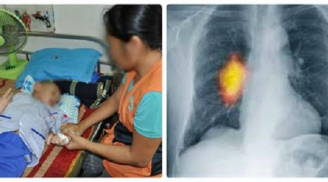 Mới 5 tuổi bị ung thư phổi giai đoạn cuối, gia đình khóc thét khi bác sĩ nói nguyên nhân