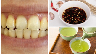 Đây là những thức ăn chị em hãy tránh xa ngay lập tức nếu không muốn hàm răng xỉn màu ố vàng xấu xí