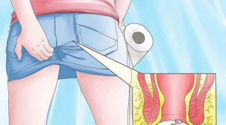Đi khám ngay nếu thấy đau khi đại tiện vì nó cảnh báo căn bệnh nguy hiểm vô cùng