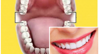 Xem số RĂNG biết tài lộc đến đâu, sinh ra đã 'ngậm thìa vàng' hay nghèo kiệt quệ, số 3 rất hiếm gặp