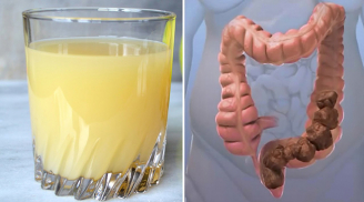 Bỏ ra 5 phút mỗi ngày lọc sạch ruột già chỉ trong một tuần theo đúng cách này, bạn sẽ vô cùng ngạc nhiên