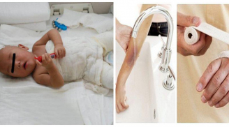 Cậu bé 17 tháng tuổi bỏng nước sôi, hành động sơ cứu của người mẹ đã giúp con thoát nạn trong gang tấc