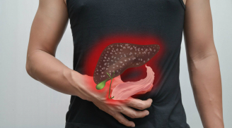 7 “sát thủ” gây hại cho gan: Nhiều người vẫn đang NUÔI LỚN chúng mà không hề biết