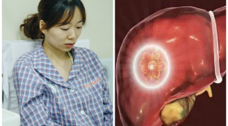 Cô giáo Hà Nội bị ung thư gan vì 2 nguyên nhân mà vô số người Việt đang mắc phải