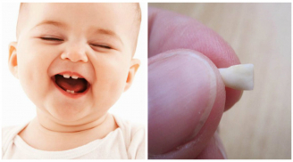 Trẻ thay răng đừng vội vứt đi, bởi chúng sẽ cứu mạng sống của con khi trưởng thành