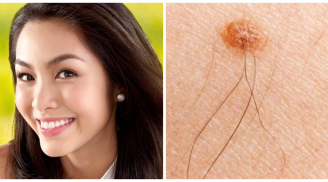 Những dấu hiệu bất ngờ trên cơ thể thông báo bạn sắp PHÁT TÀI thăng quan tiến chức nhanh chóng đổi đời